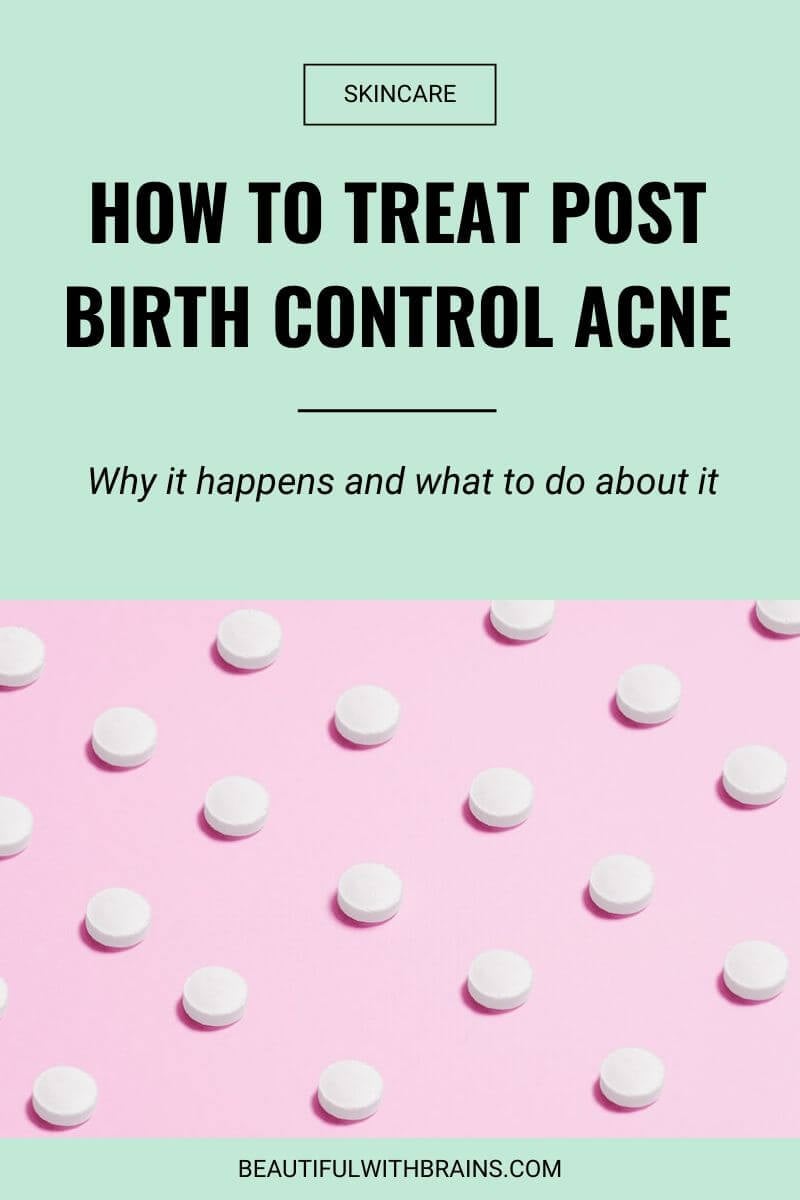 how to treat post birth control acne